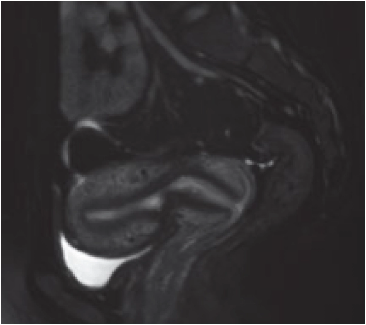 Фото uMR 770 Магнитно-резонансный томограф UTX 3.0T MR Изображение uMR 770 Магнитно-резонансный томограф UTX 3.0T MR