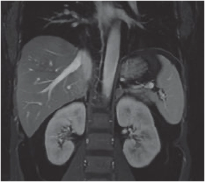 Фото uMR 770 Магнитно-резонансный томограф UTX 3.0T MR Изображение uMR 770 Магнитно-резонансный томограф UTX 3.0T MR