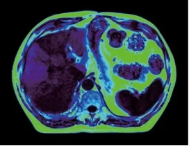 Изображение uMR 588 Магнитно-резонансный томограф UCS 1.5T МР
