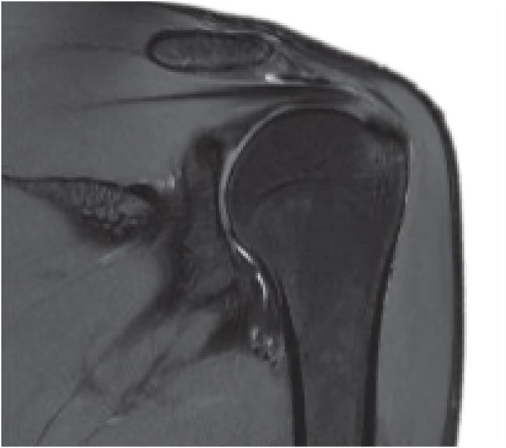 Фото uMR 770 Магнитно-резонансный томограф UTX 3.0T MR Изображение uMR 770 Магнитно-резонансный томограф UTX 3.0T MR