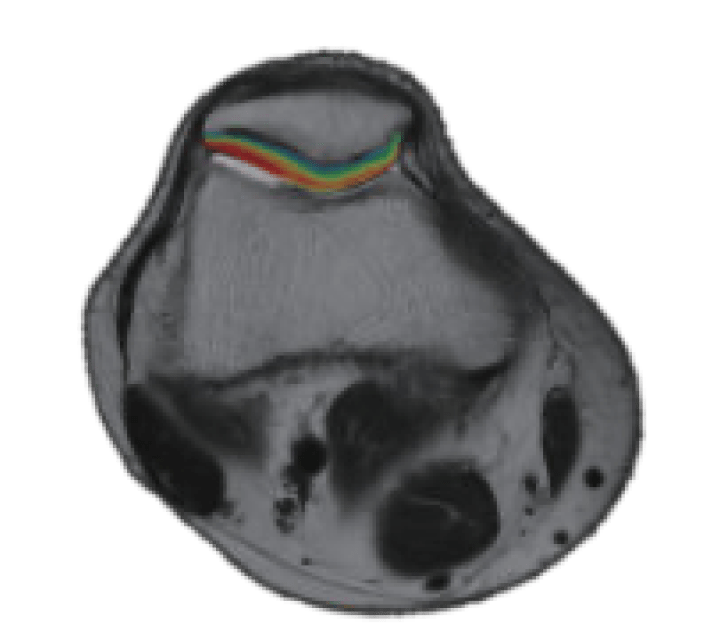 Фото uMR 770 Магнитно-резонансный томограф UTX 3.0T MR Изображение uMR 770 Магнитно-резонансный томограф UTX 3.0T MR