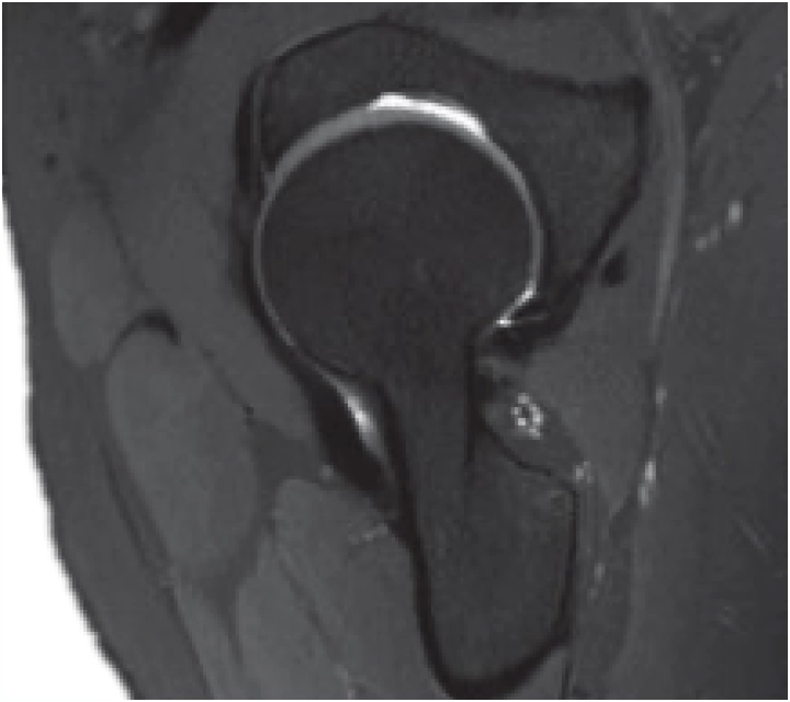 Фото uMR 770 Магнитно-резонансный томограф UTX 3.0T MR Изображение uMR 770 Магнитно-резонансный томограф UTX 3.0T MR