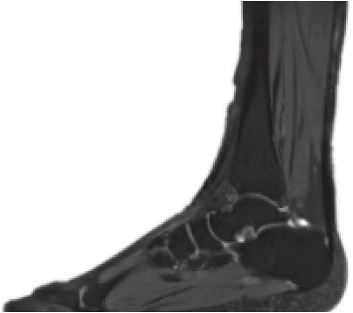 Фото uMR 770 Магнитно-резонансный томограф UTX 3.0T MR Изображение uMR 770 Магнитно-резонансный томограф UTX 3.0T MR