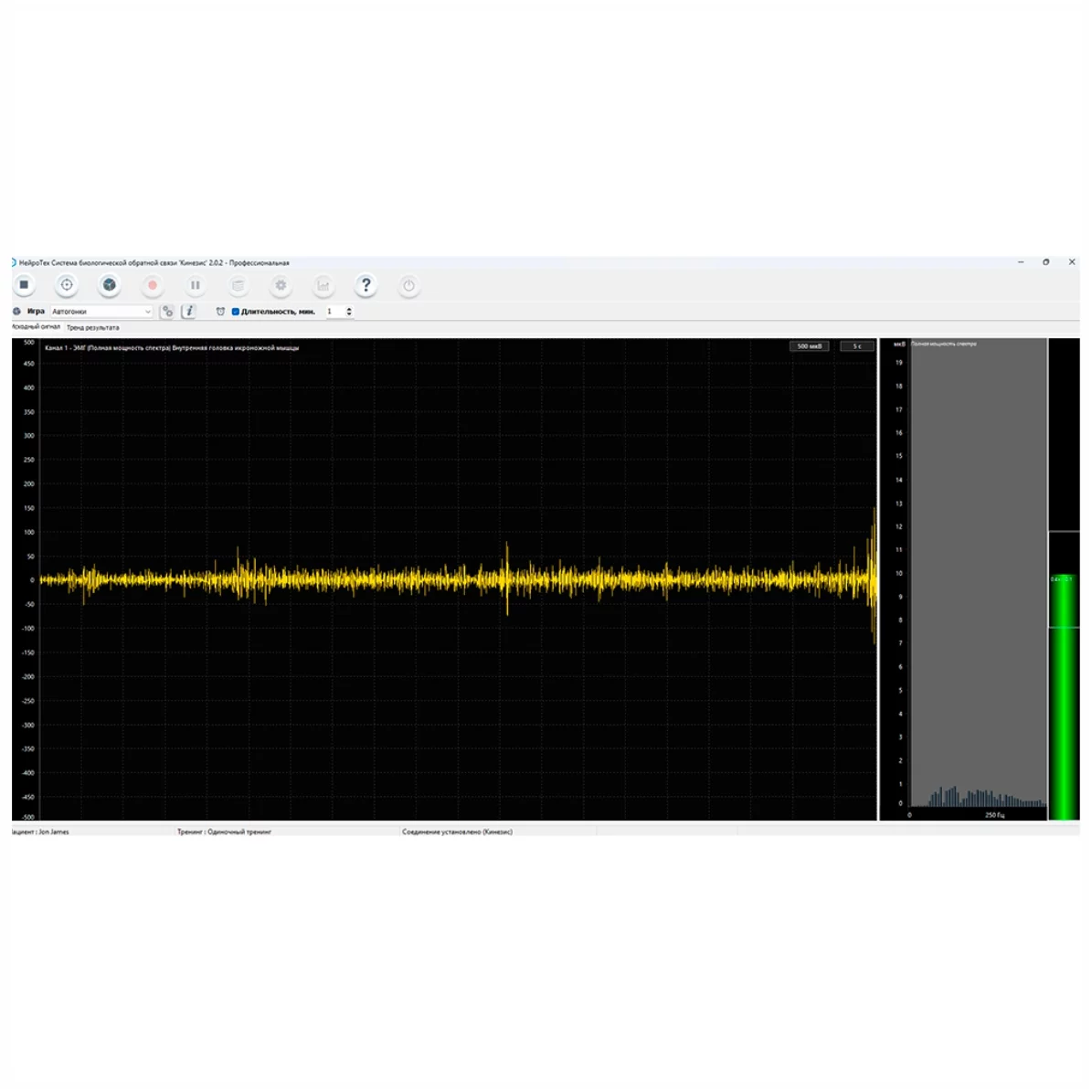Фото Система БОС «КИНЕЗИС» комплексная Изображение Система БОС «КИНЕЗИС» комплексная