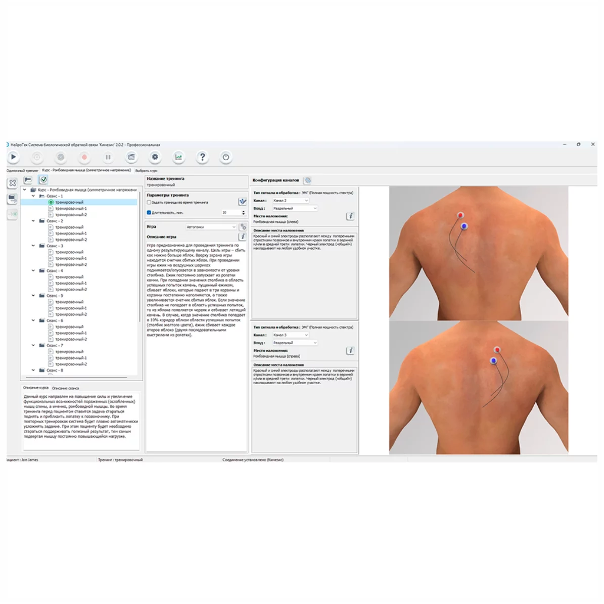 Фото Система БОС «КИНЕЗИС» комплексная Изображение Система БОС «КИНЕЗИС» комплексная