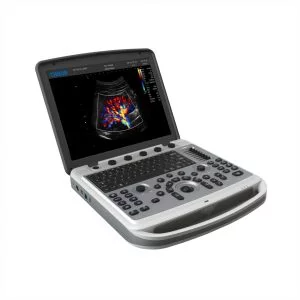 Изображение УЗИ сканер Chison SonoBook 6