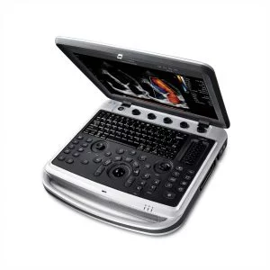 Изображение УЗИ сканер Chison SonoBook 8