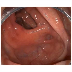 Изображение Видеоэндоскопическая система SonoScape HD-500